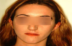 Before image