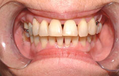 After image