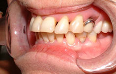 After image