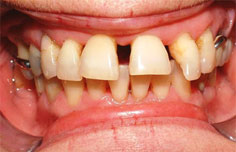 Before image