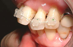 Before image
