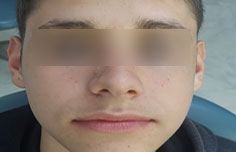 After image