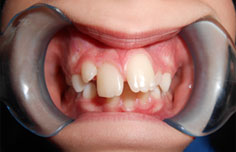 Before image