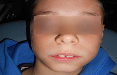 Before image