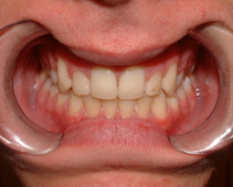 After image