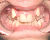 Before image