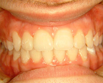After image