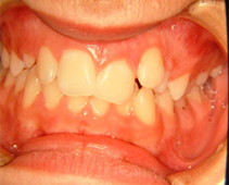 Before image