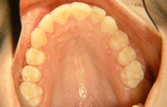 After image