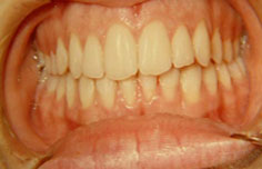 After image