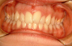 Before image
