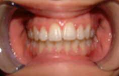 After image