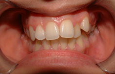 Before image