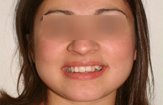 Before image