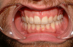 After image