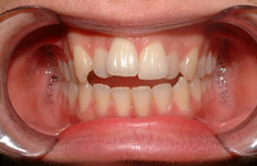 Before image